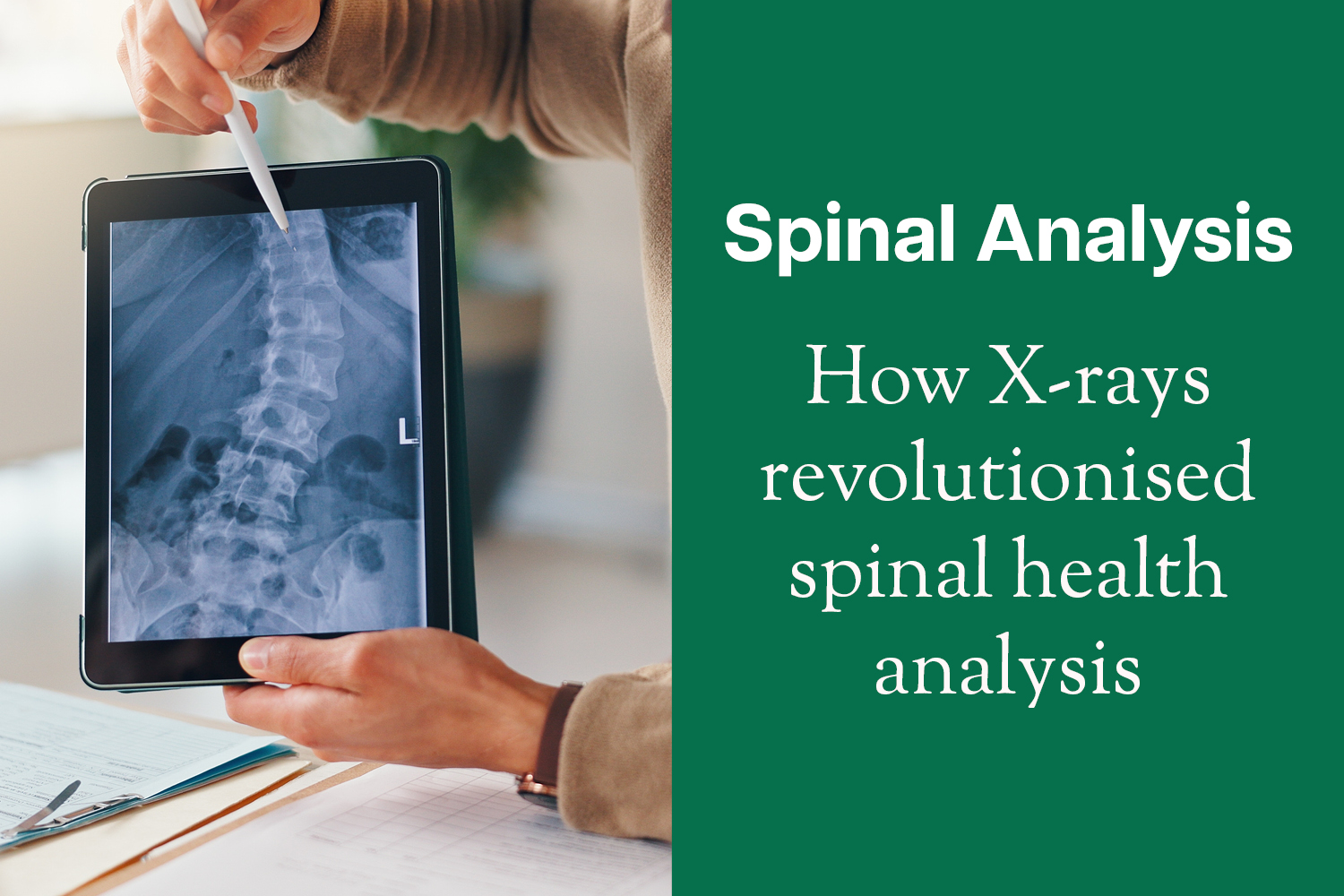 The Spinograph: How X‑Ray Practice Revolutionised Spinal Analysis